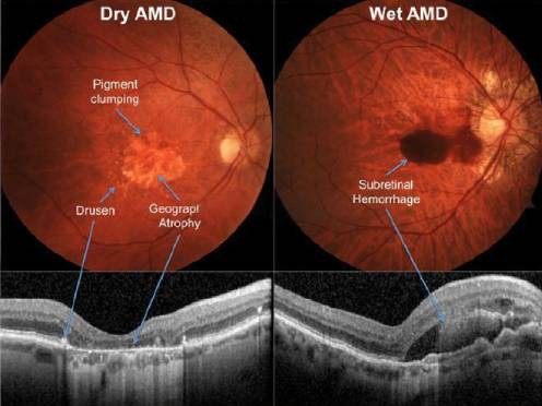 amd-496-372 amd-496-372